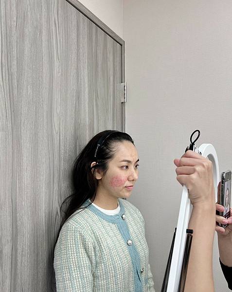 陳裕豪醫師雞尾酒技術皮秒除斑|皮醫美南勢角診所