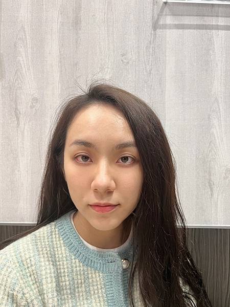 陳裕豪醫師雞尾酒技術皮秒除斑|皮醫美南勢角診所