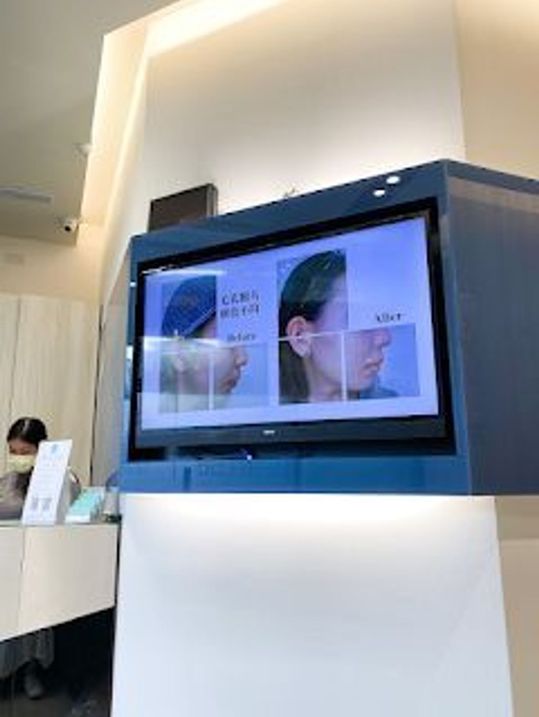 高階抗老陳裕豪醫師 嚴重鬆弛無痛筋膜多層次埋線拉提 困難斑點雞尾酒技術皮秒雷射除斑
