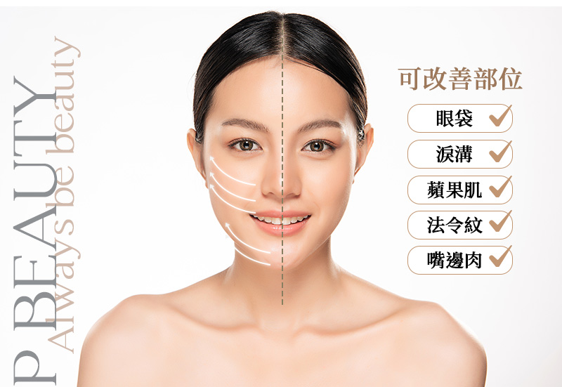 中下臉埋線0816