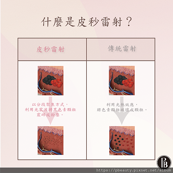 台北皮秒除斑陳裕豪醫師2