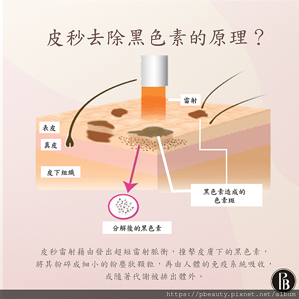 台北皮秒除斑陳裕豪醫師3