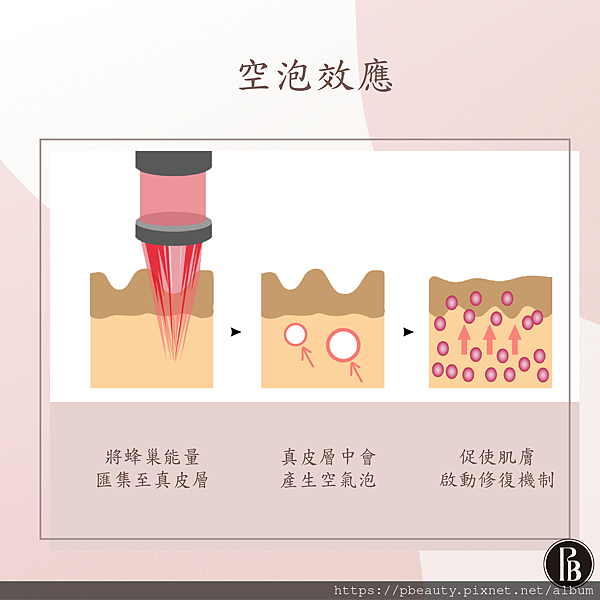 台北皮秒除斑陳裕豪醫師4