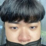 陳裕豪醫師4D三段式埋線隆鼻|皮醫美南勢角診所