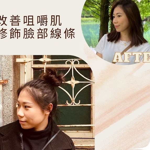 陳裕豪醫師 高階微整技術 肉毒瘦臉