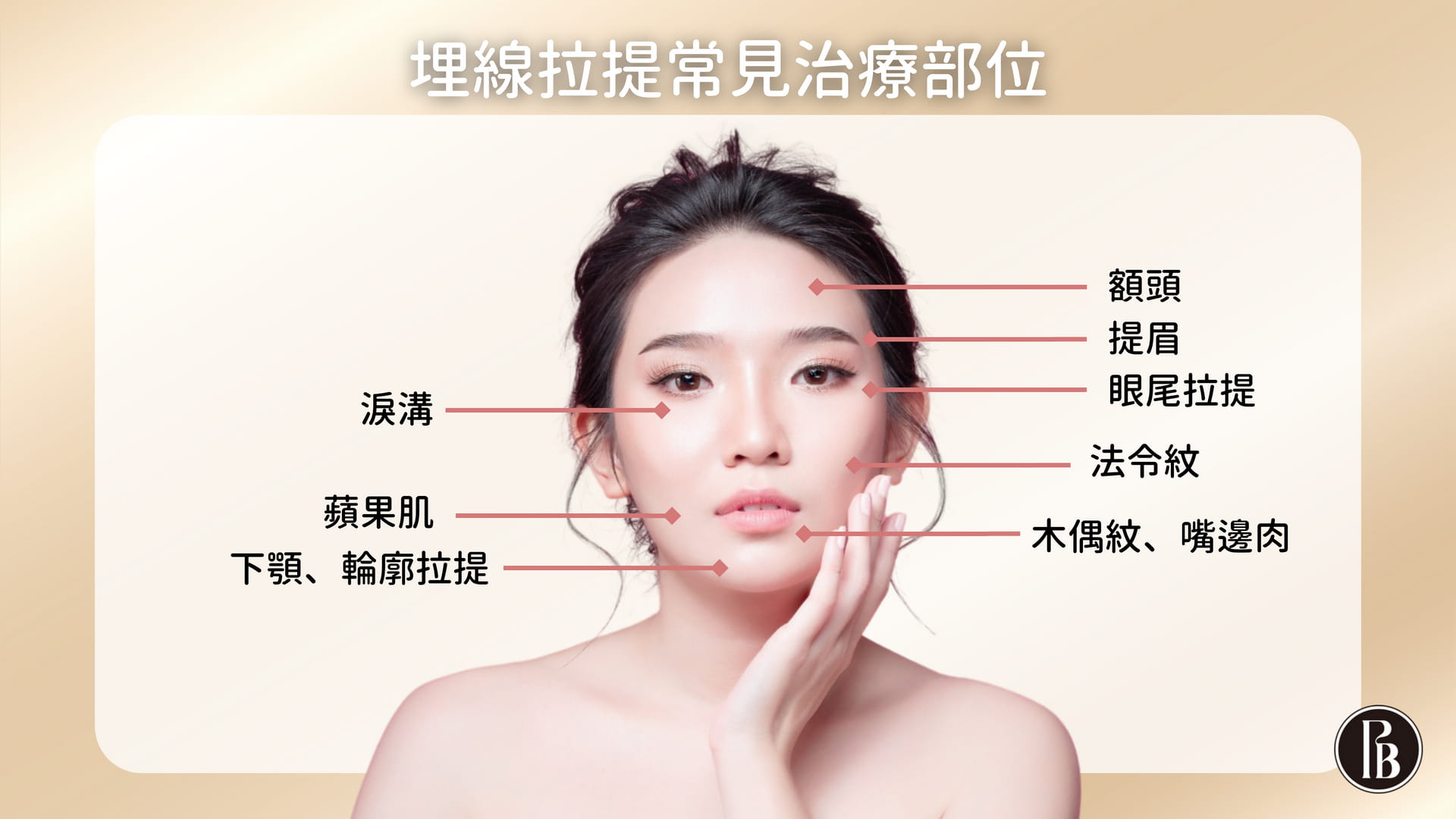 陳裕豪醫師無痛筋膜多層次埋線拉提