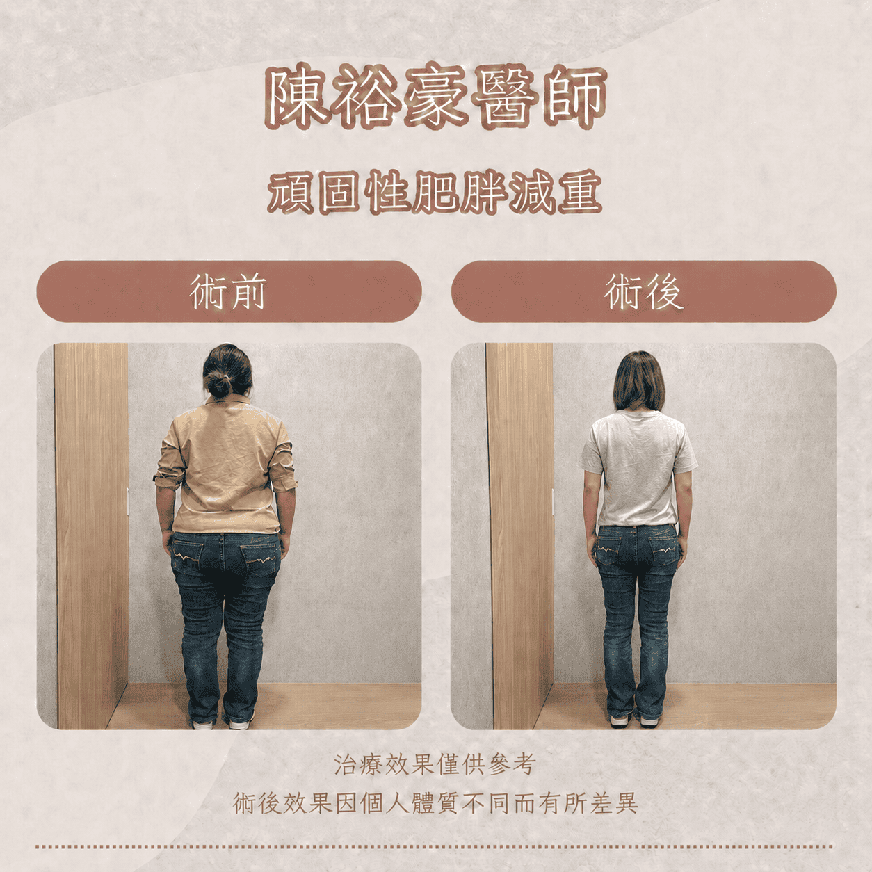 瑞提診所陳裕豪醫師女性減重案例，術前術後背面比較腰臀比例、臀腿脂肪與下半身體態線條變化