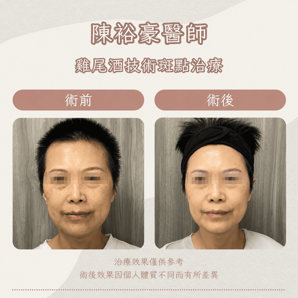 高階抗老 陳裕豪醫師 皮秒除斑