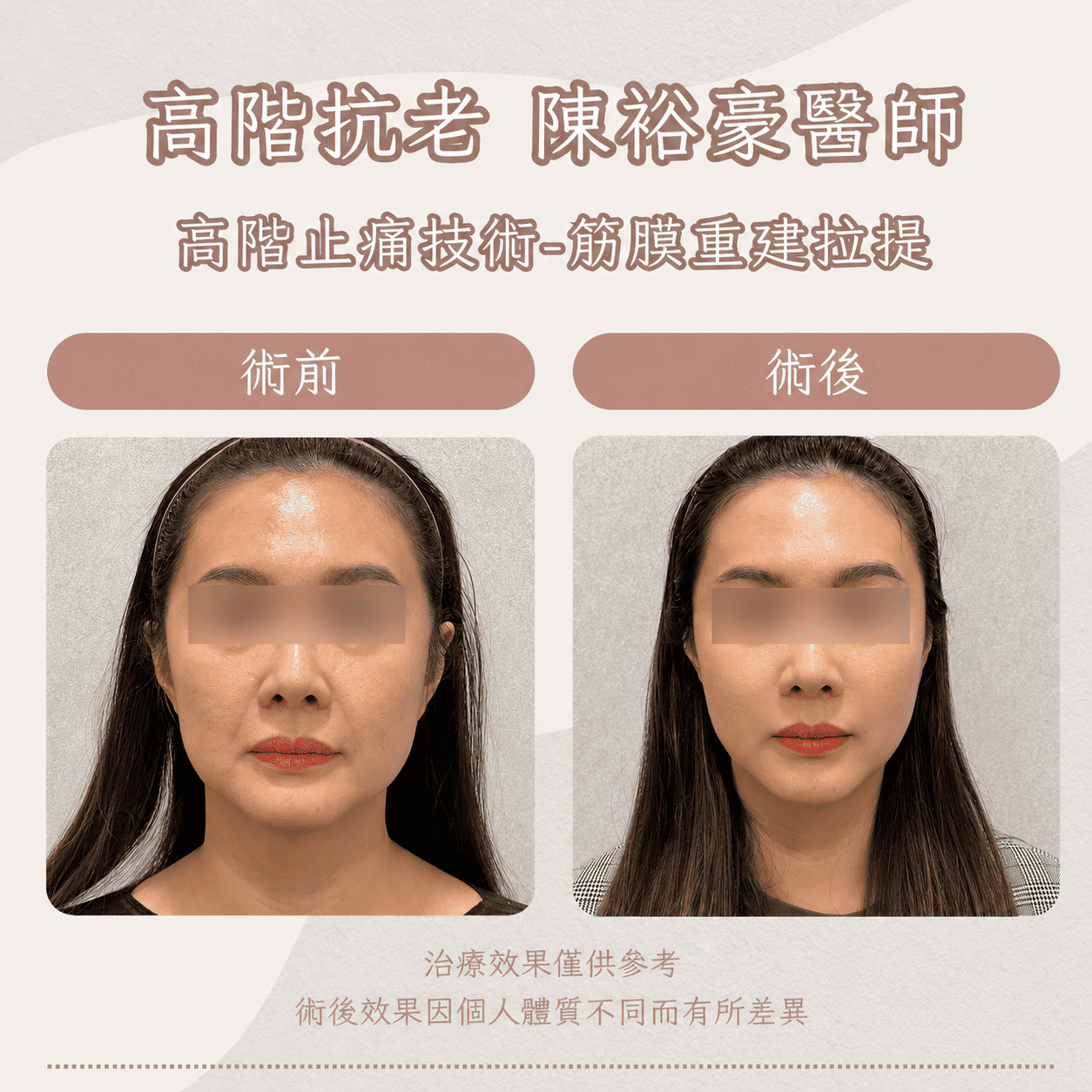 高階抗老 陳裕豪醫師 高階止痛技術-筋膜重建抗老拉提