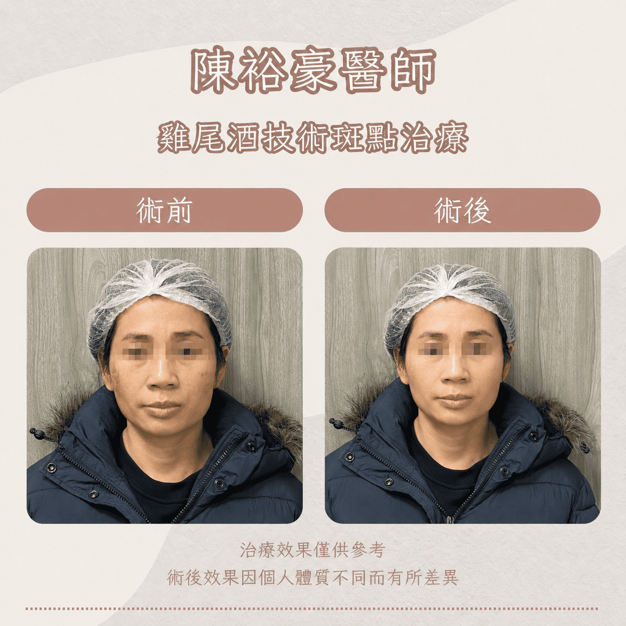 高階抗老 陳裕豪醫師 皮秒除斑