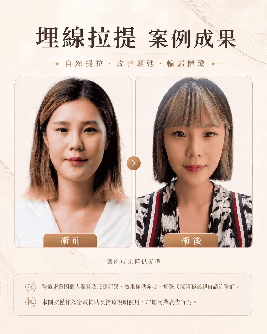 高階抗老 陳裕豪醫師 筋膜拉提 埋線拉提 瑞提診所