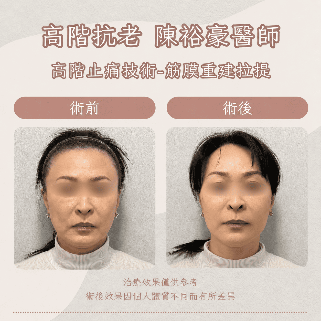 高階抗老 陳裕豪醫師 高階止痛技術-筋膜重建抗老拉提