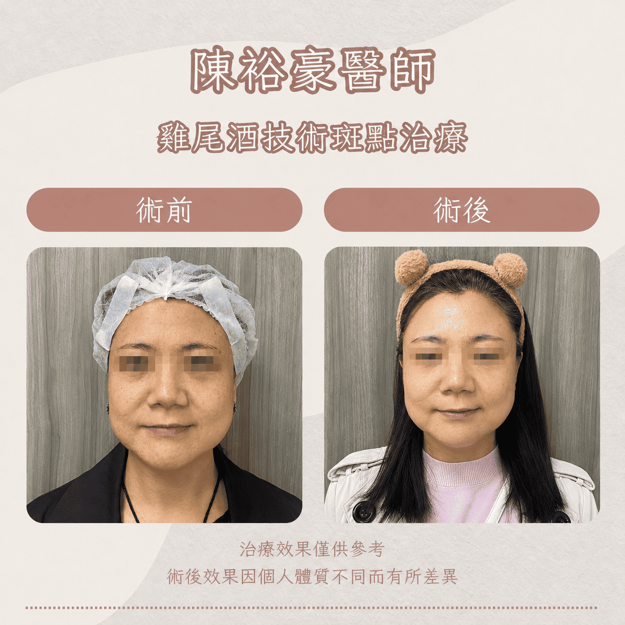 高階抗老 陳裕豪醫師 皮秒除斑