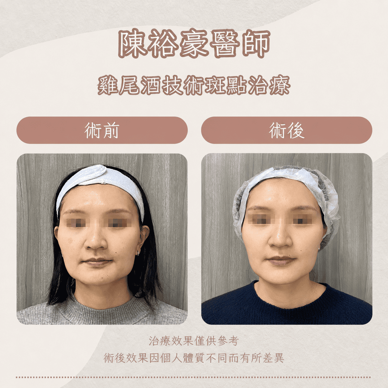 高階抗老 陳裕豪醫師 皮秒除斑