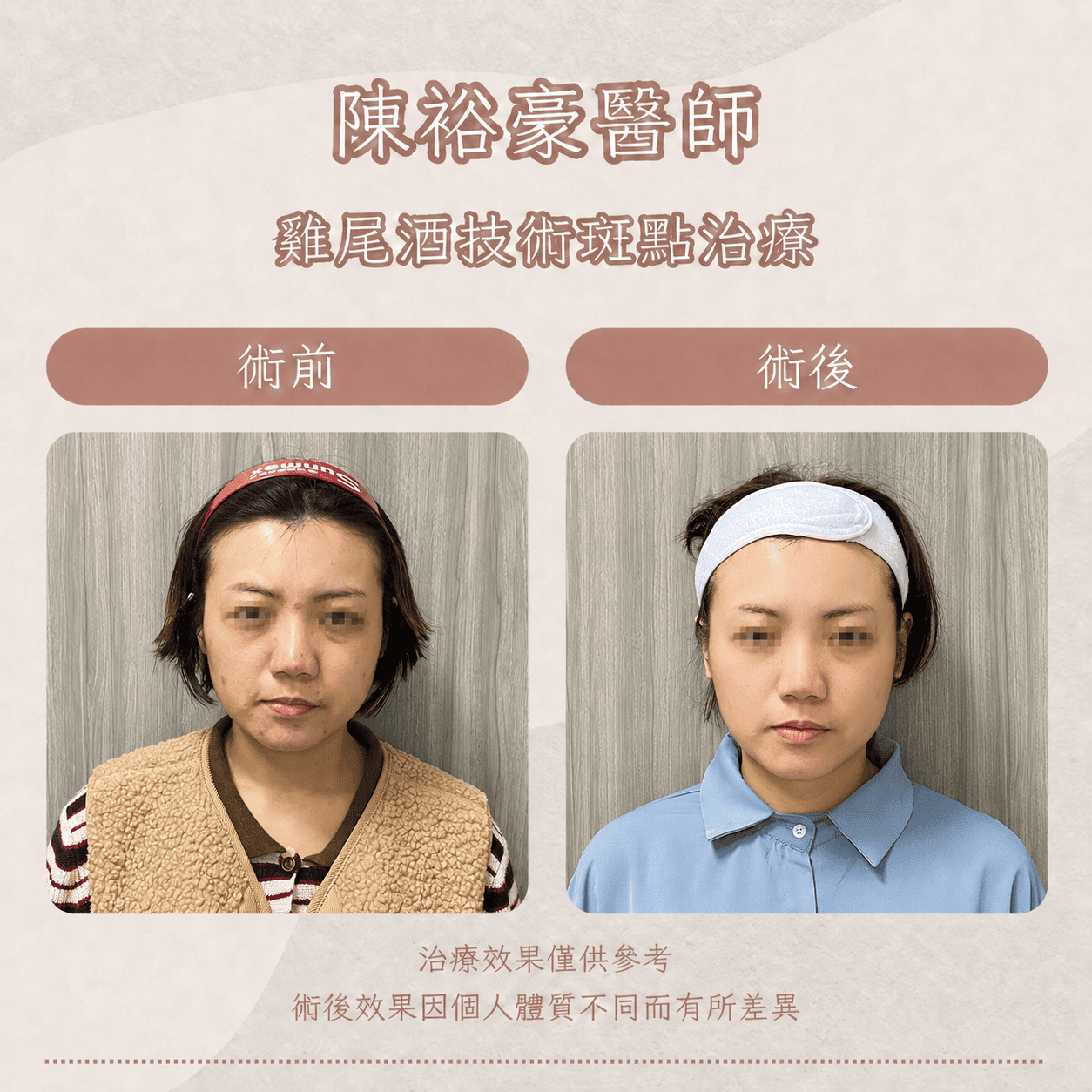 高階抗老 陳裕豪醫師 皮秒除斑