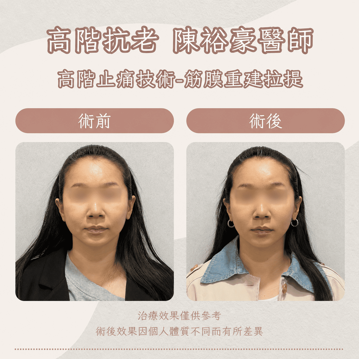 高階抗老 陳裕豪醫師 高階止痛技術-筋膜重建抗老拉提