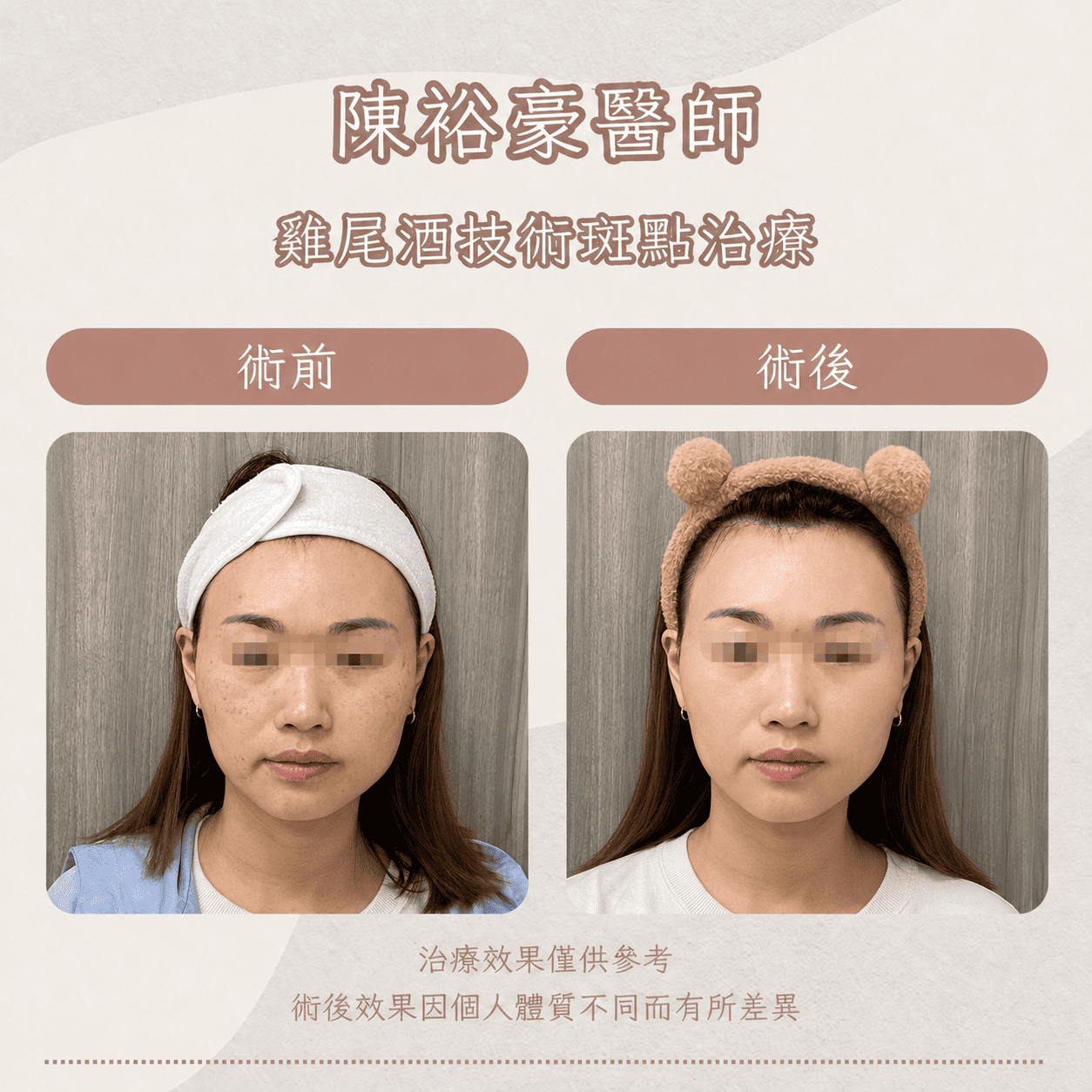 高階抗老 陳裕豪醫師 皮秒除斑