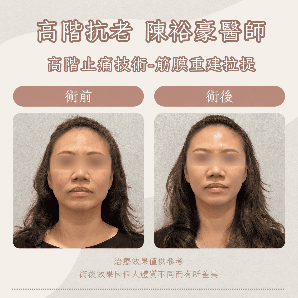 高階抗老 陳裕豪醫師 高階止痛技術-筋膜重建抗老拉提