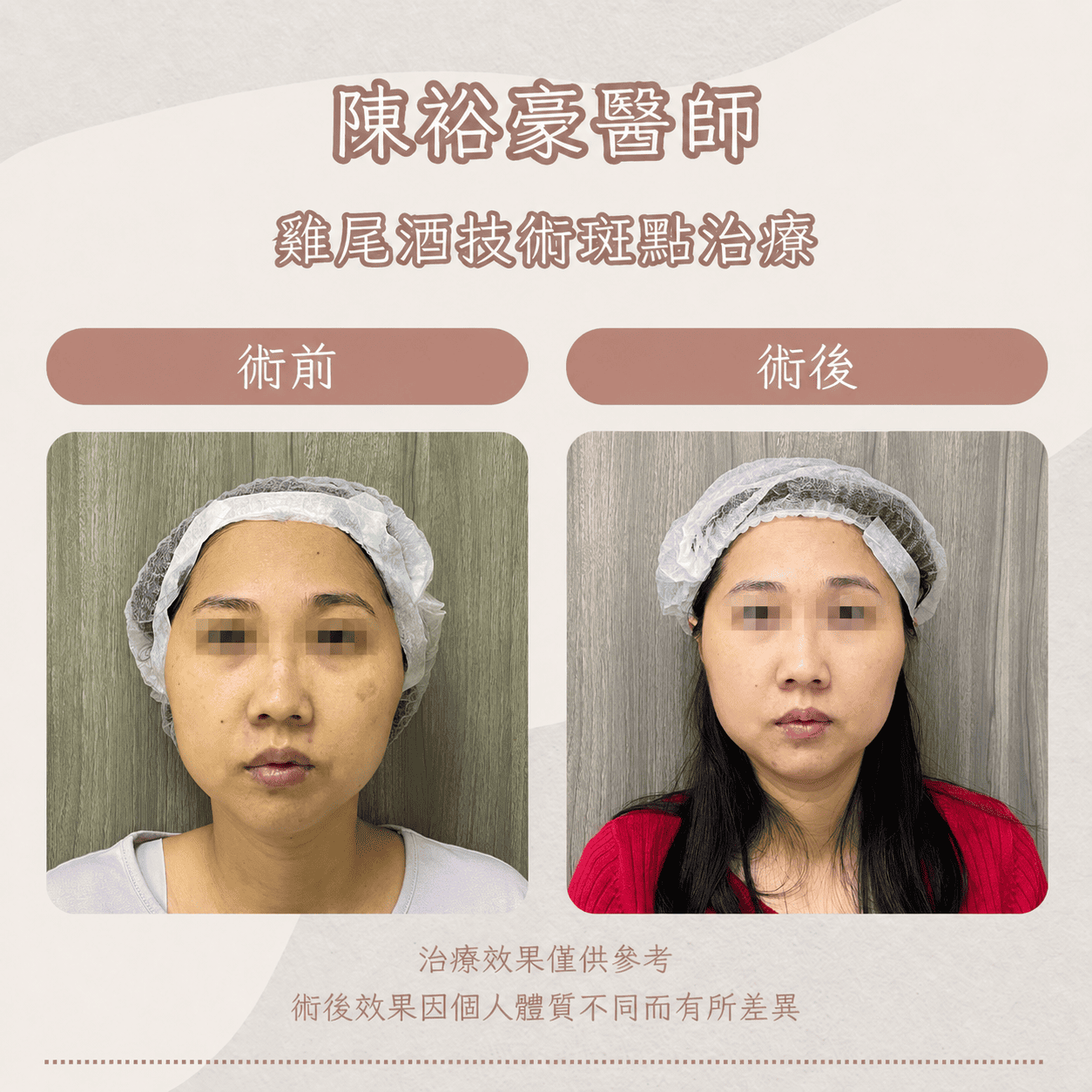 高階抗老 陳裕豪醫師 皮秒除斑