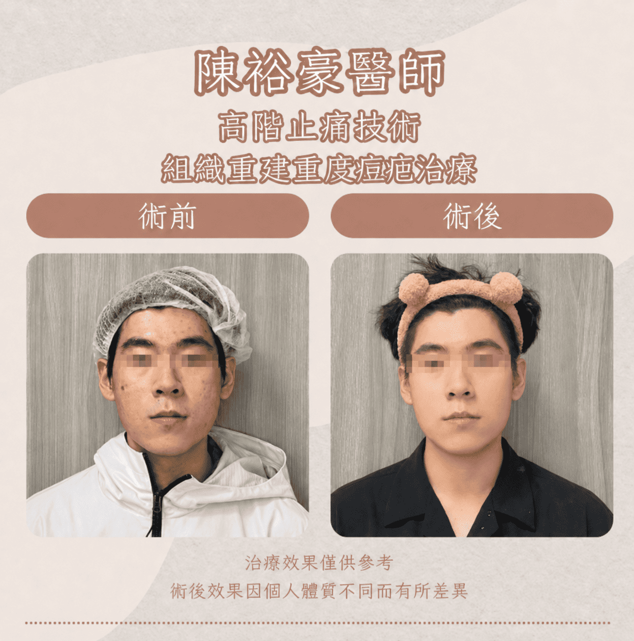 高階抗老 陳裕豪醫師 痘疤治療