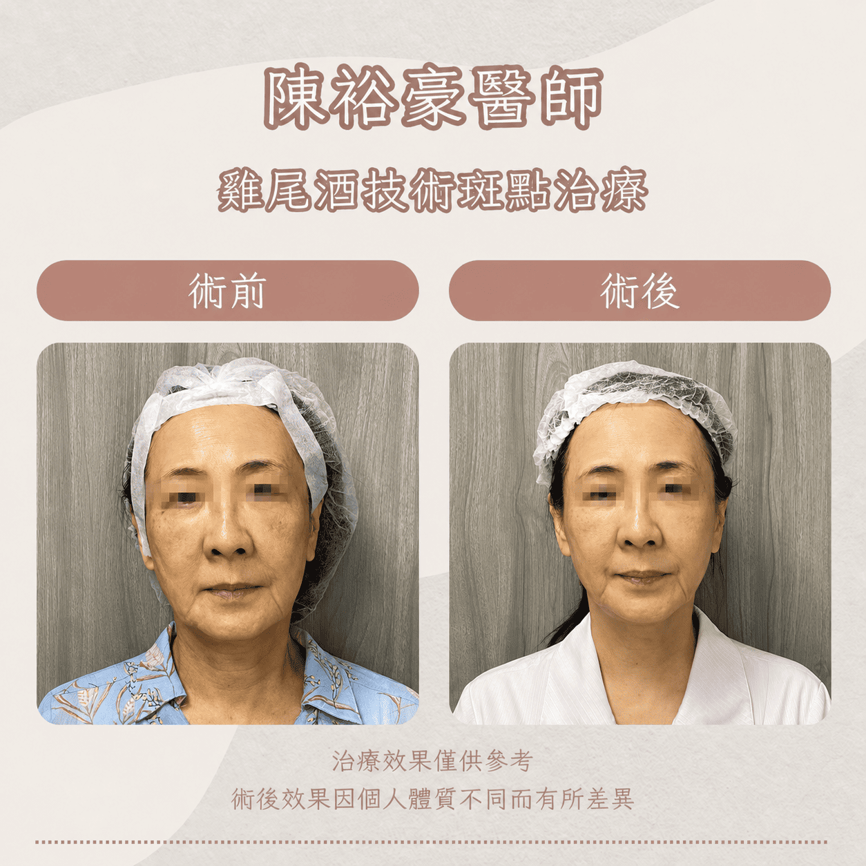 高階抗老 陳裕豪醫師 皮秒除斑