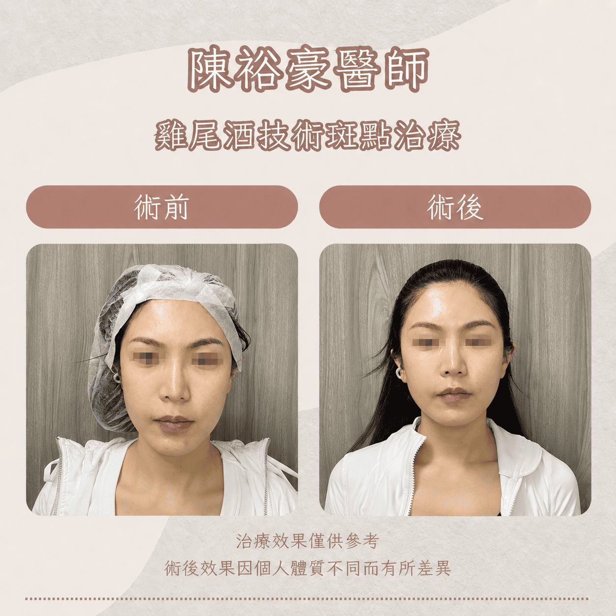 高階抗老 陳裕豪醫師 皮秒除斑