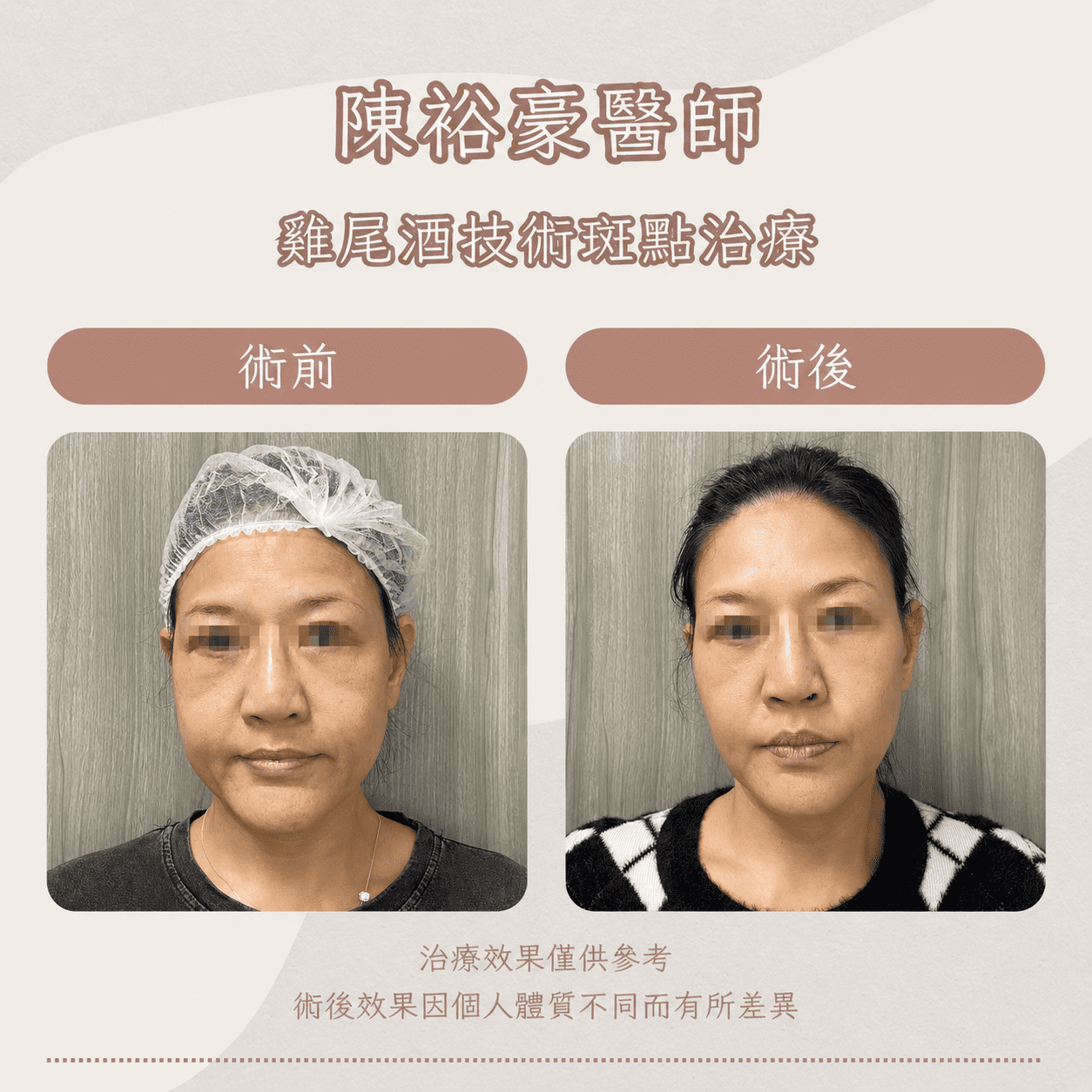 高階抗老 陳裕豪醫師 皮秒除斑