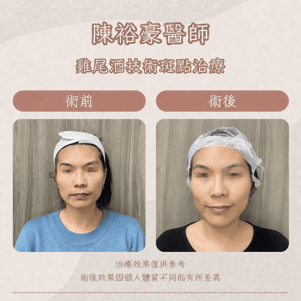 高階抗老 陳裕豪醫師 皮秒除斑