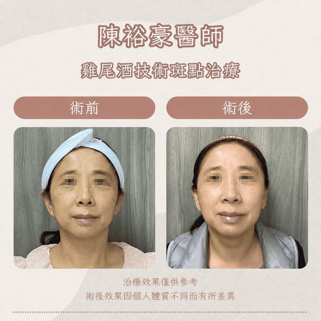 高階抗老 陳裕豪醫師 皮秒除斑