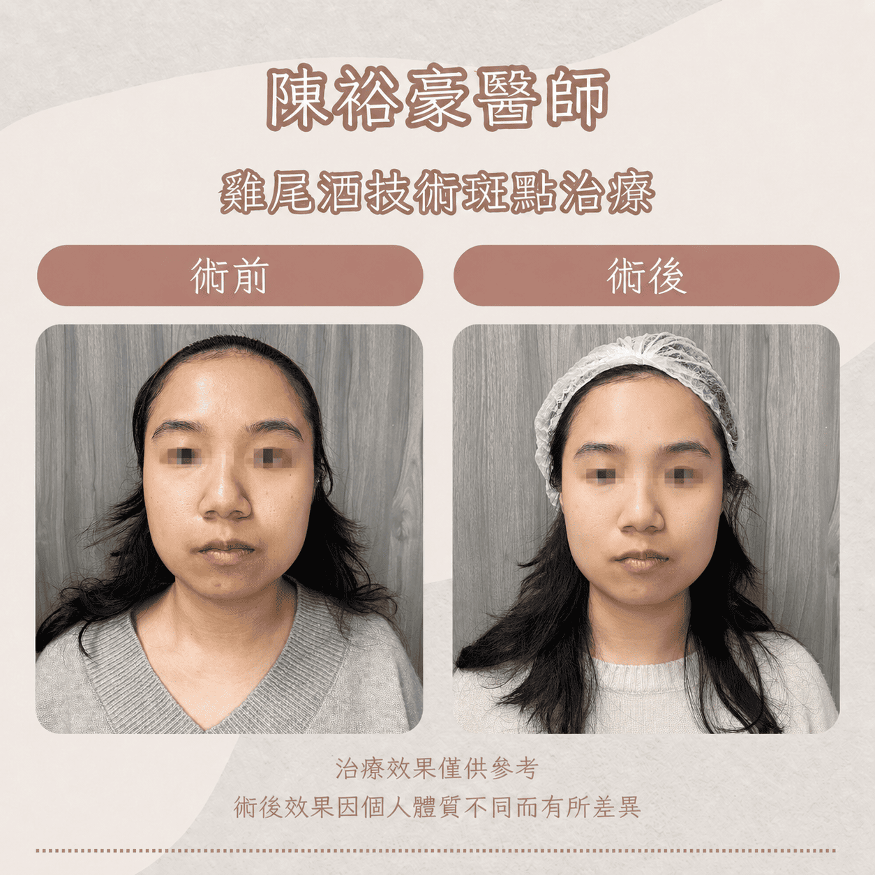 高階抗老 陳裕豪醫師 皮秒除斑