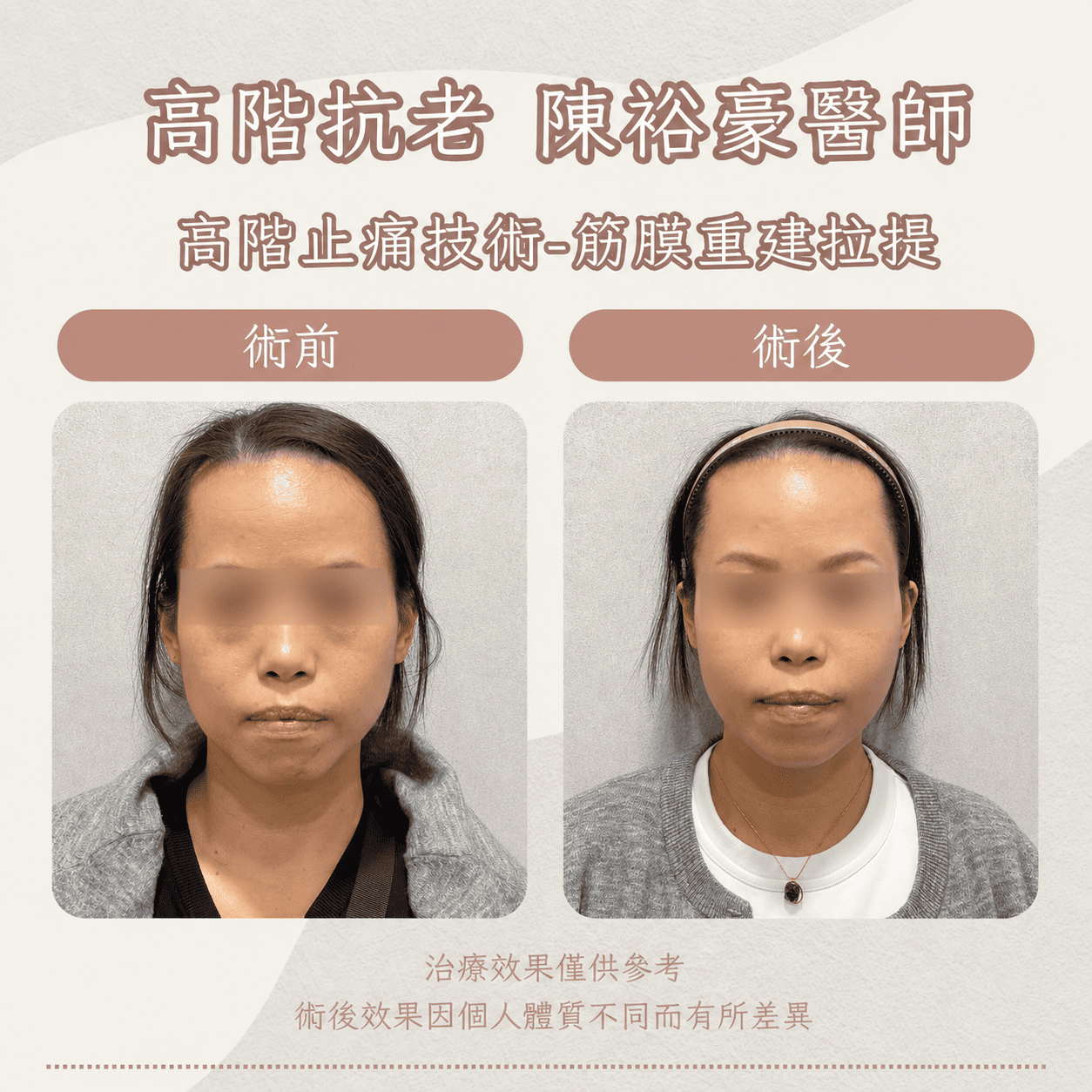 高階抗老 陳裕豪醫師 高階止痛技術-筋膜重建抗老拉提