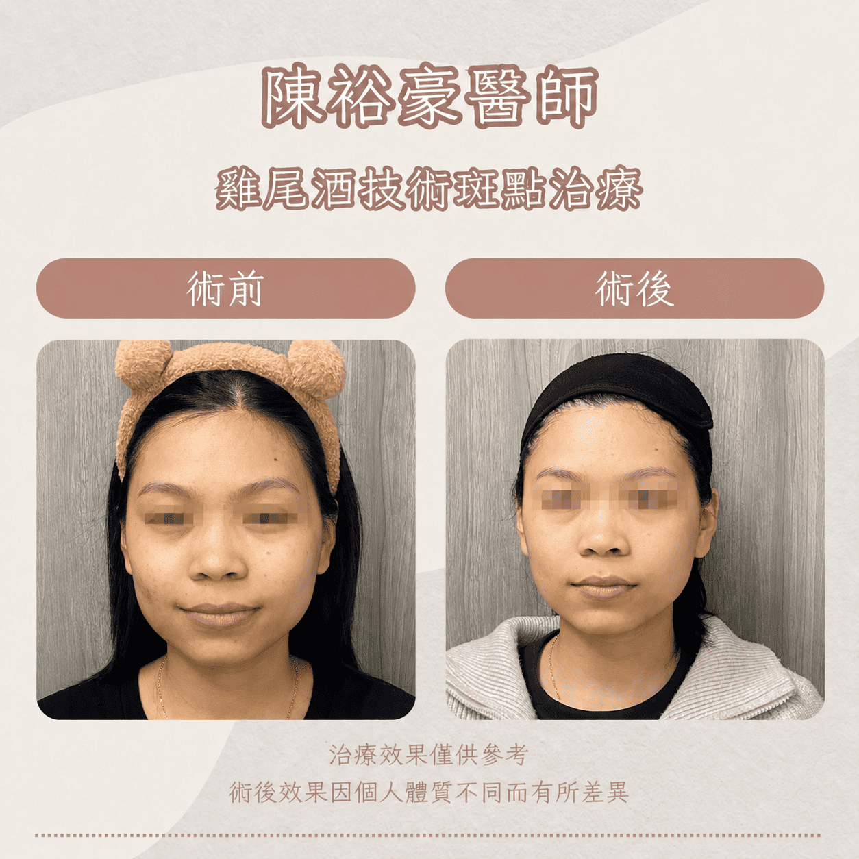 高階抗老 陳裕豪醫師 皮秒除斑