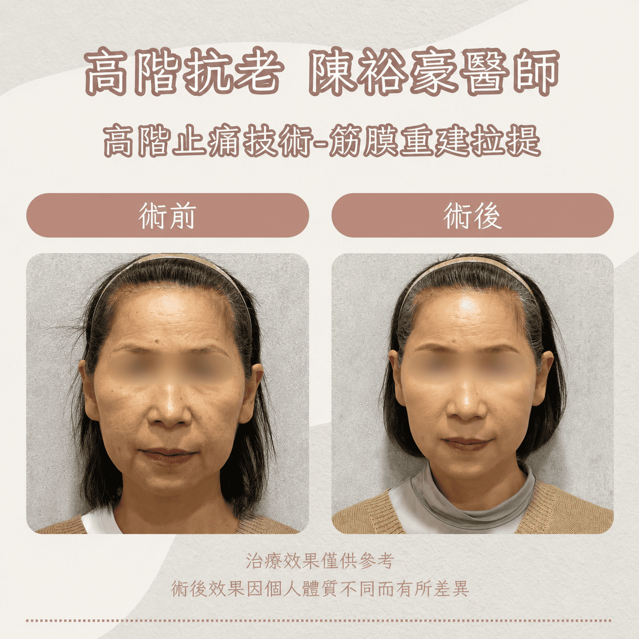 高階抗老 陳裕豪醫師 高階止痛技術-筋膜重建抗老拉提