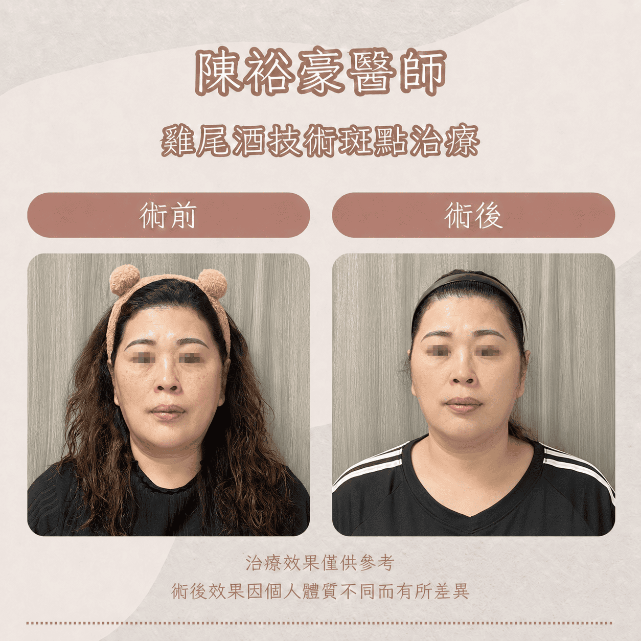高階抗老 陳裕豪醫師 皮秒除斑