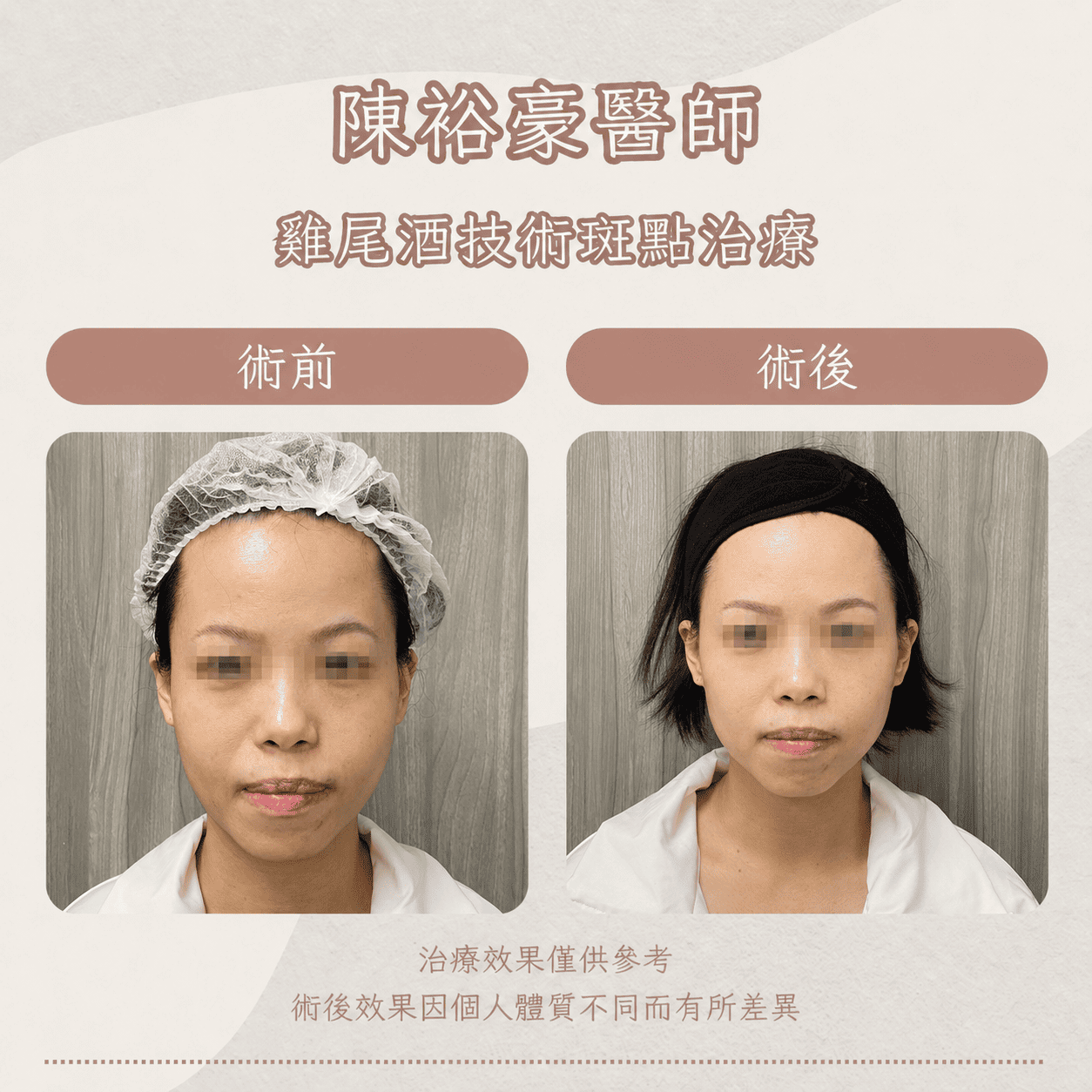 高階抗老 陳裕豪醫師 皮秒除斑