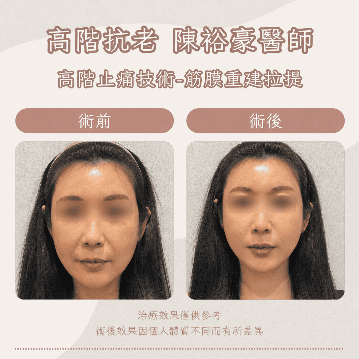 高階抗老 陳裕豪醫師 高階止痛技術-筋膜重建抗老拉提