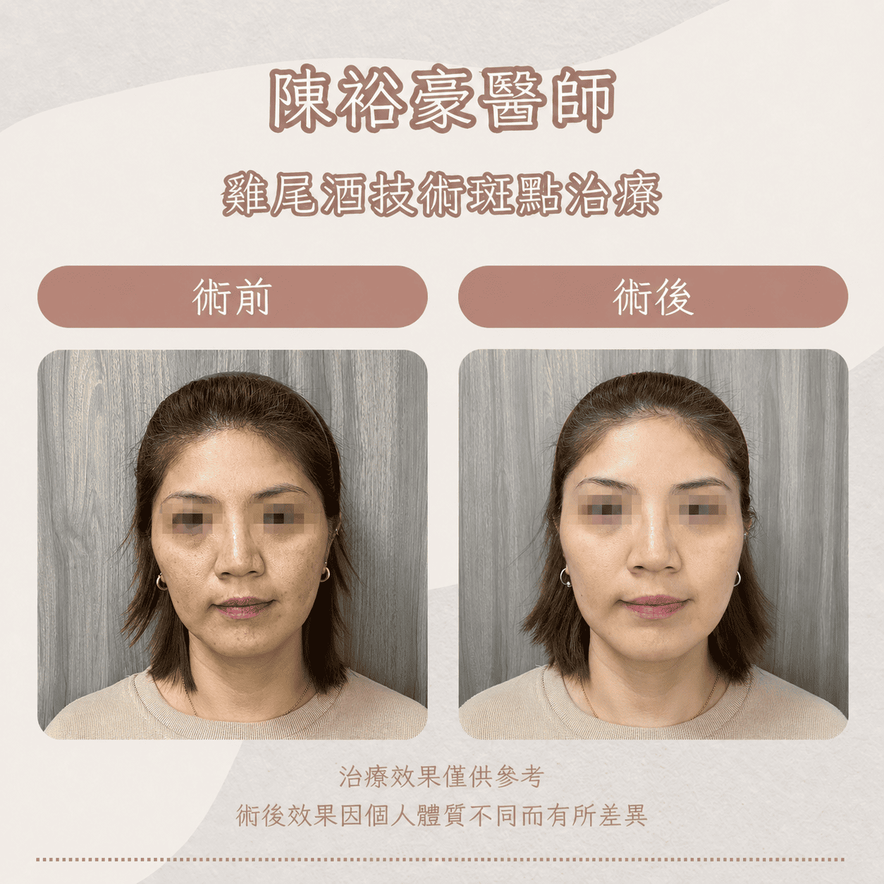 高階抗老 陳裕豪醫師 皮秒除斑