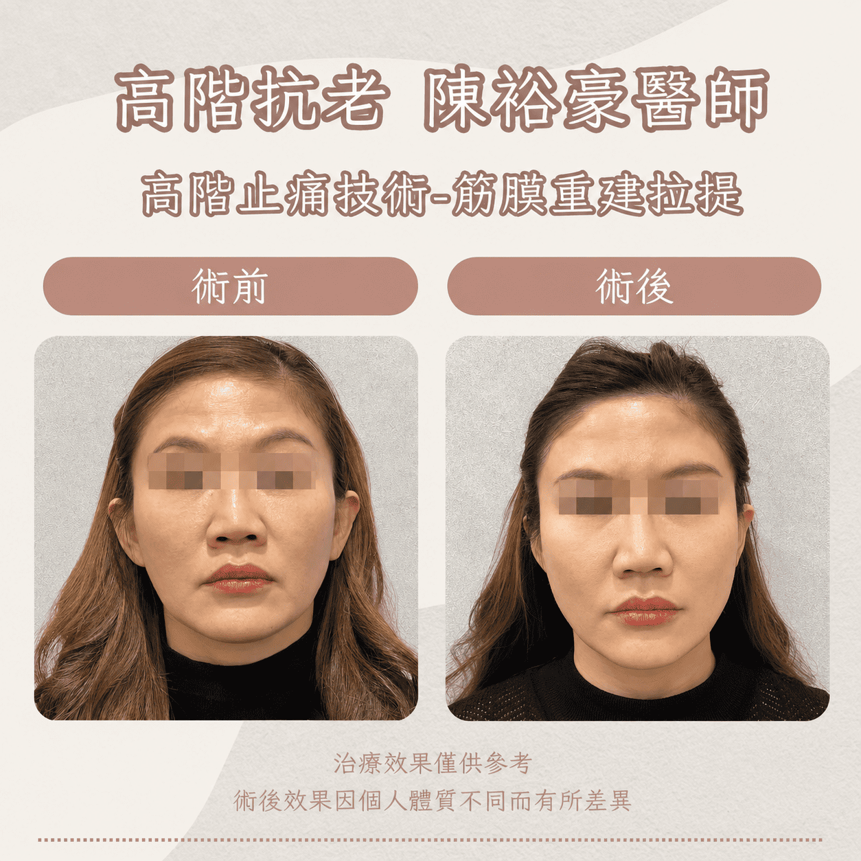 高階抗老 陳裕豪醫師 高階止痛技術-筋膜重建抗老拉提