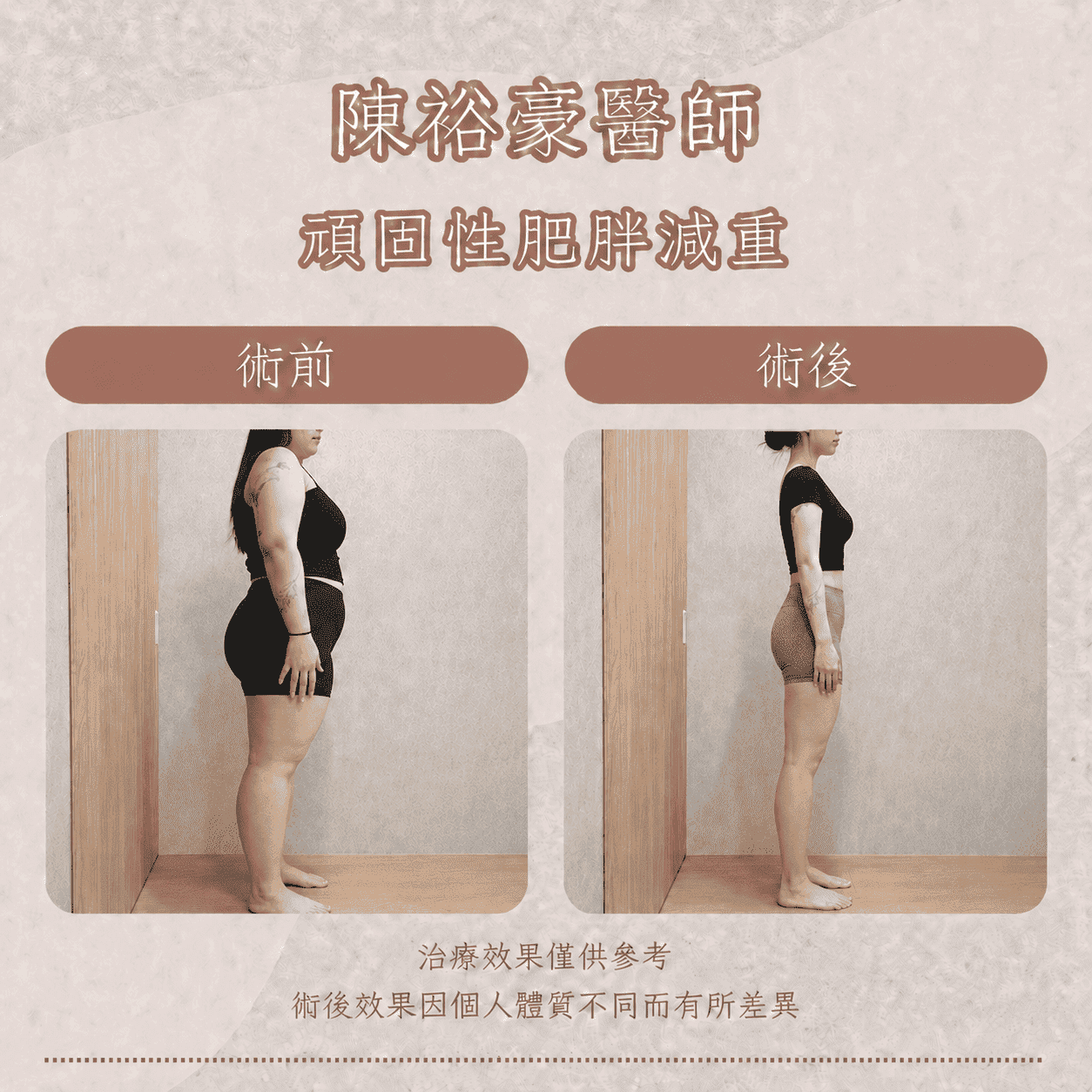 高階抗老 陳裕豪醫師 瑞提診所 頑固性肥胖減重 胰島素阻抗