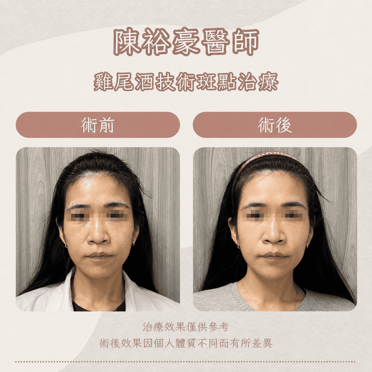 高階抗老 陳裕豪醫師 皮秒除斑