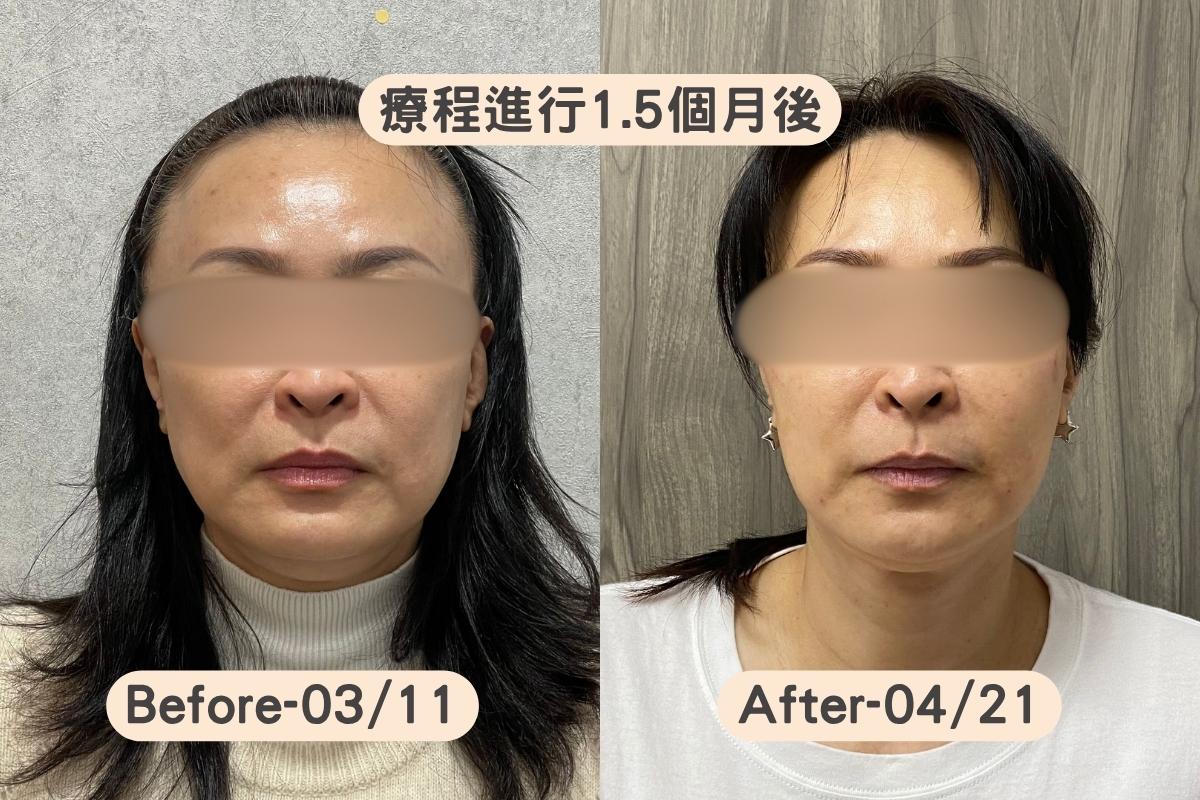 IN艾娜蓓是由陳裕豪醫師推薦的低刺激保養品牌，針對敏感肌、乾燥肌與雷射療程後肌膚乾燥緊繃族群，提供溫和清潔、保濕補水與屏障照護型保養選擇。