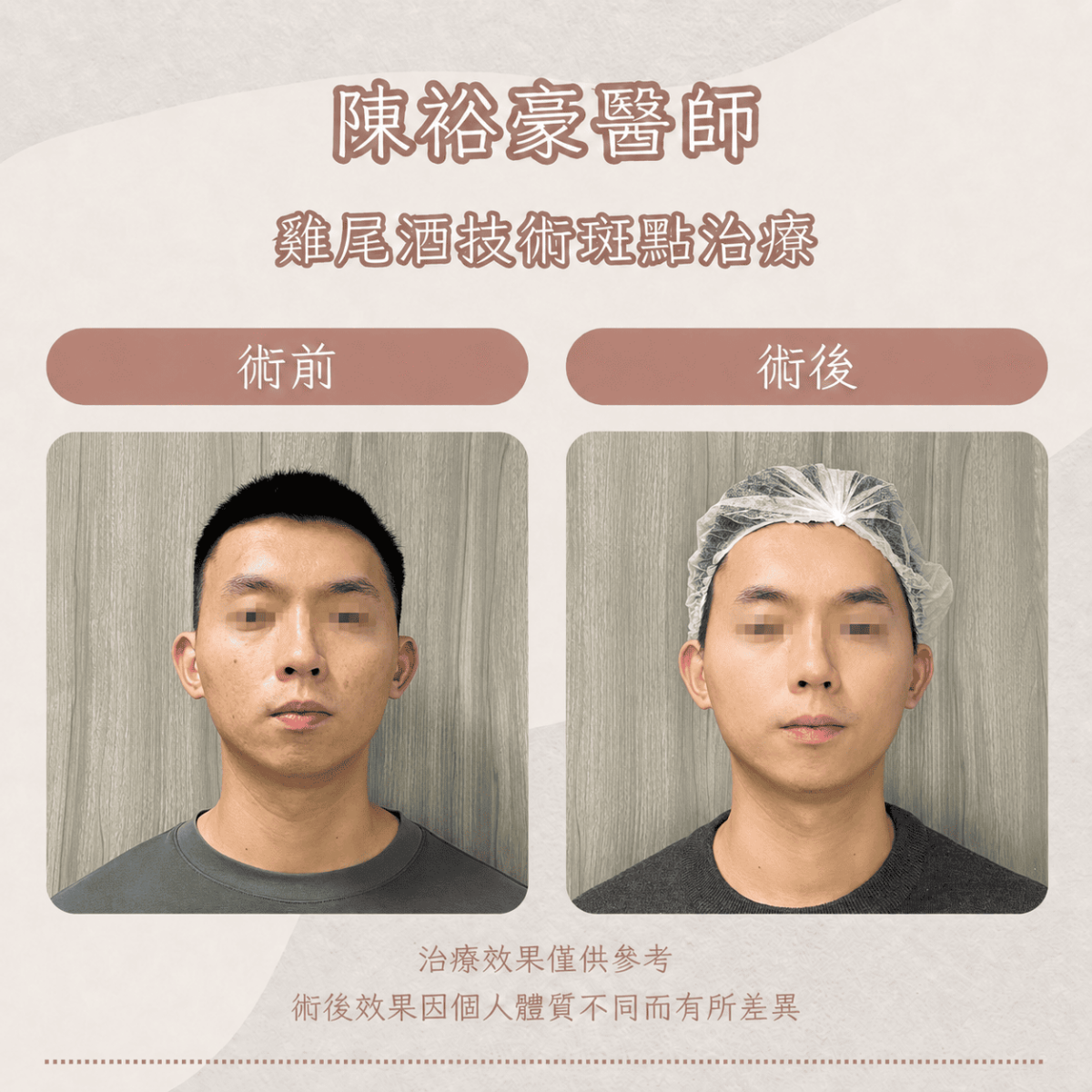 皮秒16_0