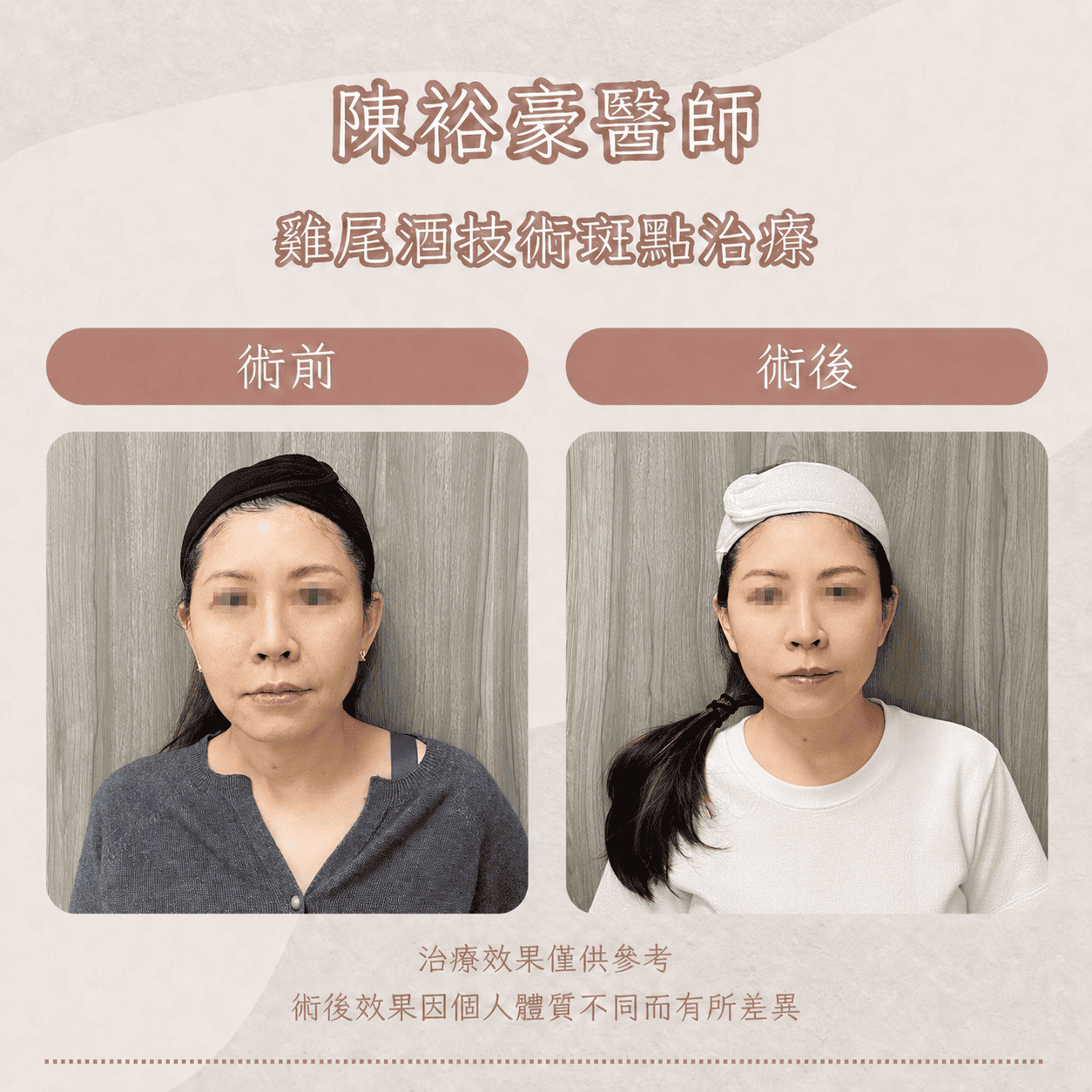 皮秒23_0