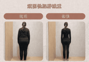 減重2_0