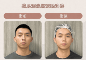皮秒16_0