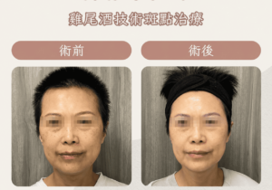 皮秒1_0