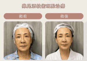 皮秒3_0
