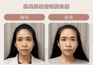 皮秒9_0